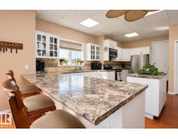 53027 Rge Road 225, Rural Strathcona County, AB T8A4T7 Photo 44