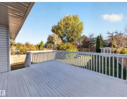 310 Regency Dr, Sherwood Park, AB T8A5W6 Photo 56