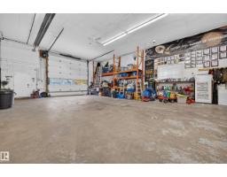 #253 52349 Rge Road 233, Rural Strathcona County, AB T8B1C8 Photo 68
