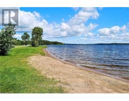 331 Port Colony Road, Kawartha Lakes, ON K0M1A0 Photo 29