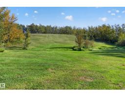 48137 Rge Rd 232, Rural Leduc County, AB T0C1Z0 Photo 43
