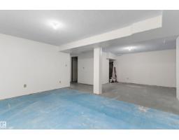 156 Dunluce Rd Nw, Edmonton, AB T5X4N9 Photo 32
