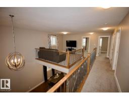 7704 Ellesmere Ln, Sherwood Park, AB T8H0P7 Photo 22