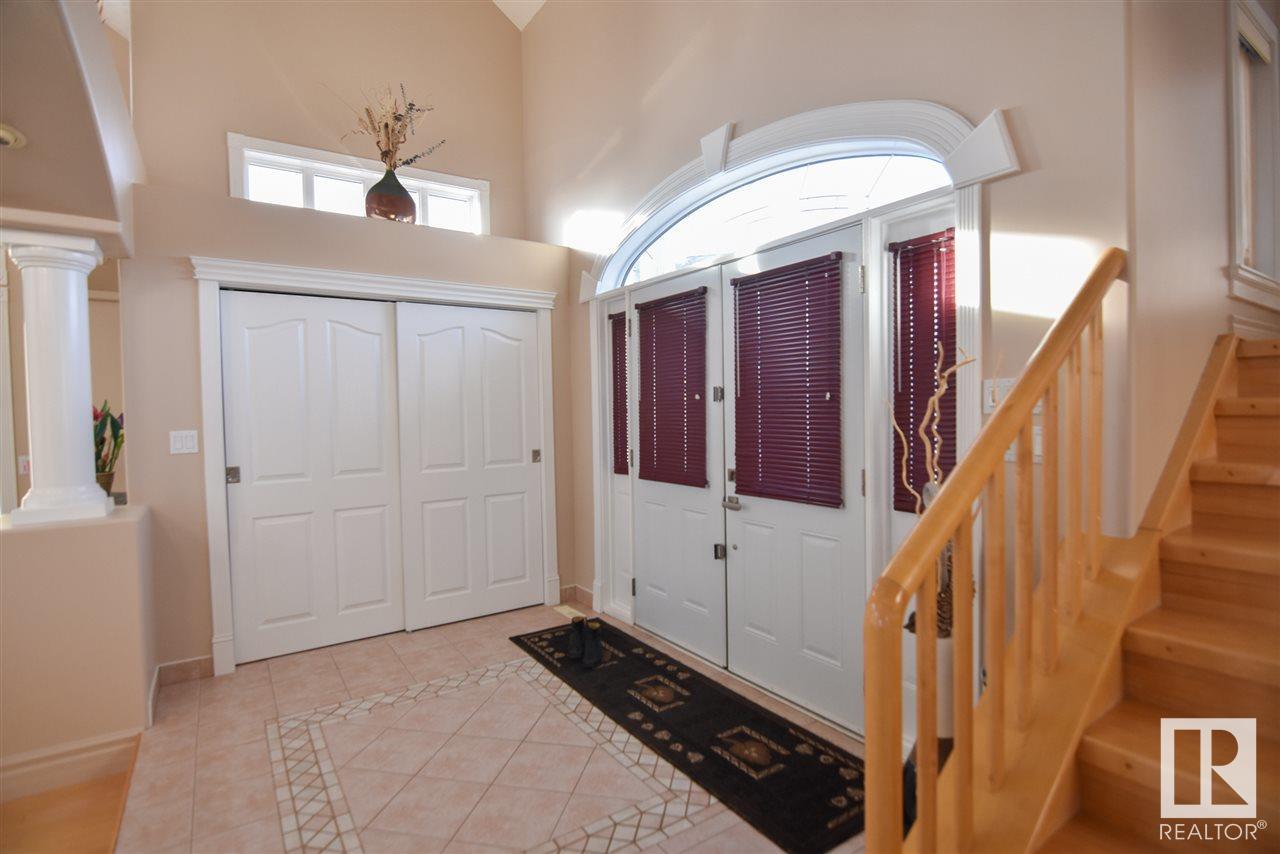 Property at 16115 57 ST NW image 2