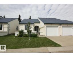 #51 9718 176 St Nw Terra Losa, Edmonton, Ca