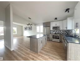 16307 112 St Nw Lorelei, Edmonton, Ca