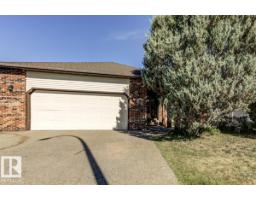 669 Village Dr Village On The Lake, Sherwood Park, Ca