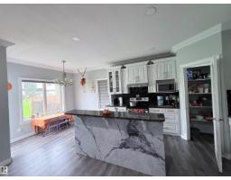 15116 32 ST NW Kirkness
