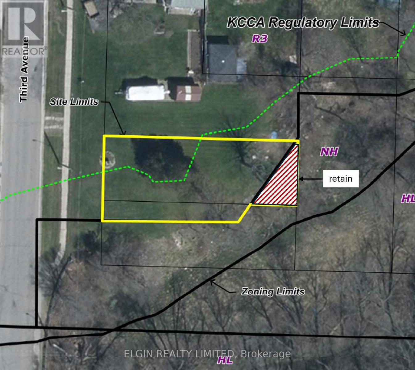 36 Third Avenue, St. Thomas, Ontario  N5R 4K1 - Photo 18 - X13030968