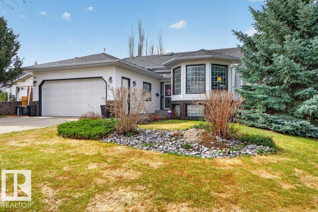 63 Charlton Rd, Sherwood Park, Alberta  T8H 1R5 - Photo 2 - E4487188