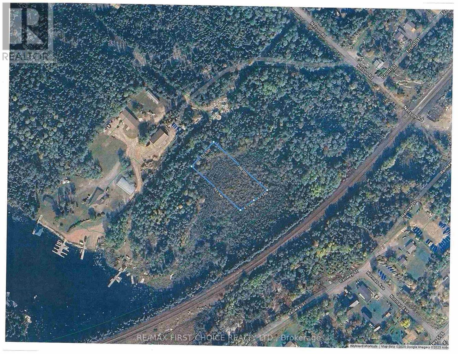 Lot 151 Plan M222, Kenora Remote Area, Ontario  P0X 1J0 - Photo 20 - X13251820